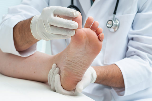 shutterstock Doctor dermatologist examines the foot on the presence of athlete's foot