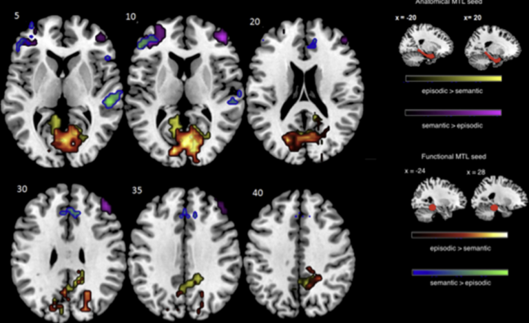 Intrinsic medial temporal lobe connectivity relates to individual differences in episodic autobiographical remembering